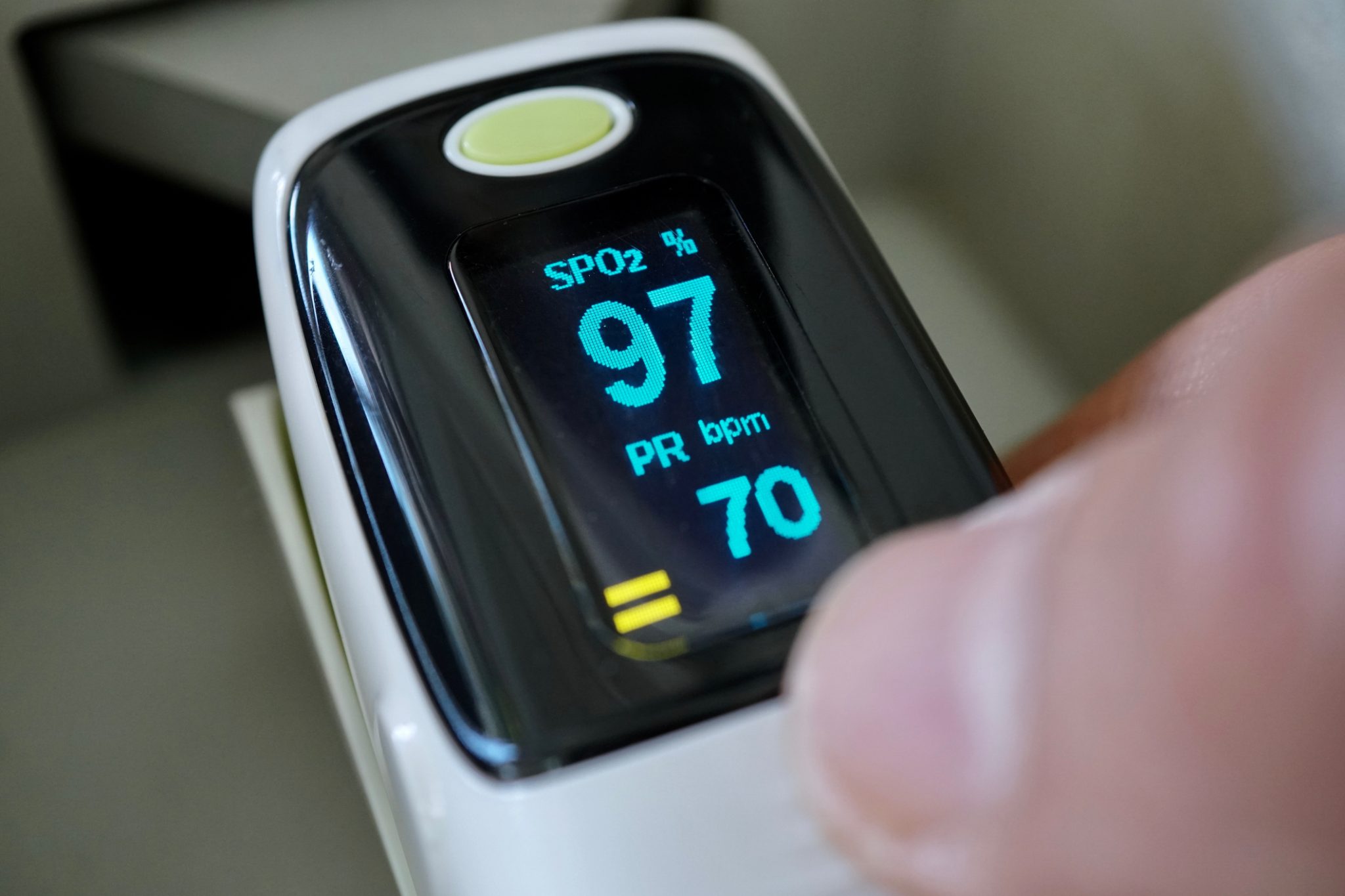 Arterial Blood Gases and Pulse Oximetry